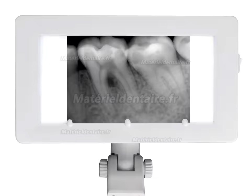 Négatoscope radiographie dentaire 24 V pour fauteuil dentaire